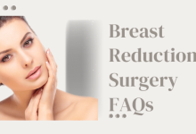 breast reduction surgery faqs