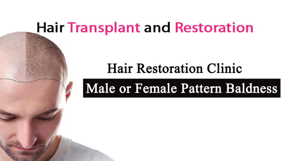 Hair restoration clinic- Hair Restoration Clinic For Male or Female Pattern Baldness